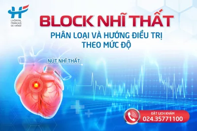 Block nhĩ thất: Phân loại và hướng điều trị theo mức độ